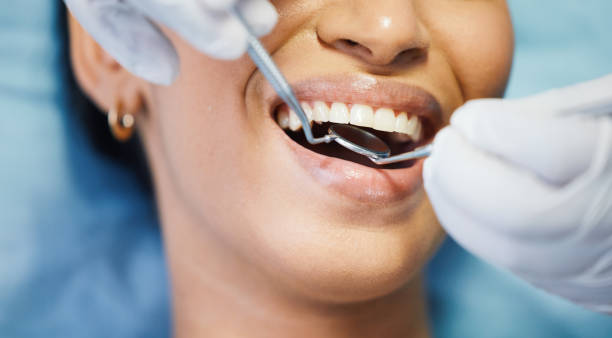 Best Emergency Broken Tooth Repair in Roma, TX